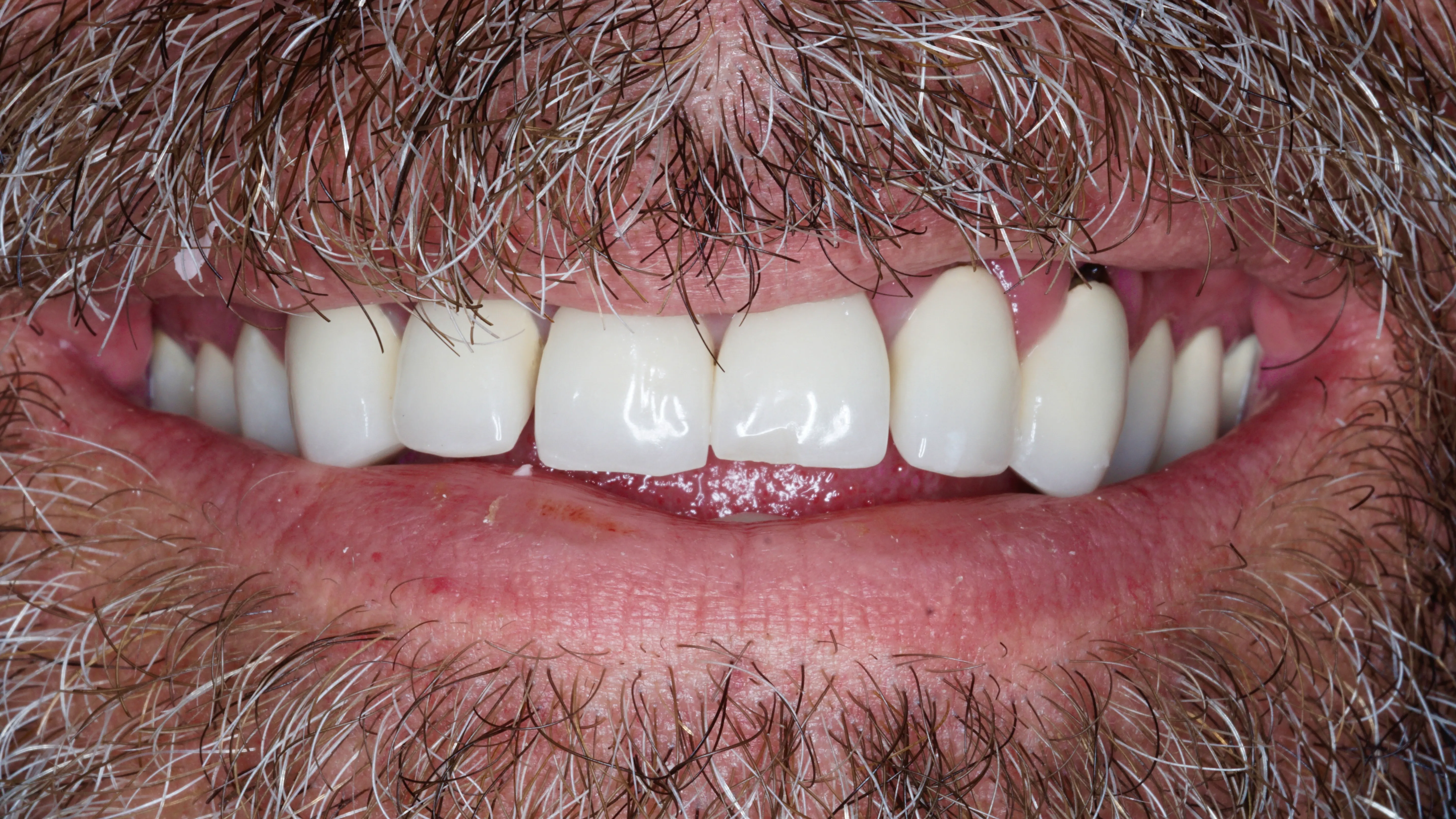 Patient smile before treatment